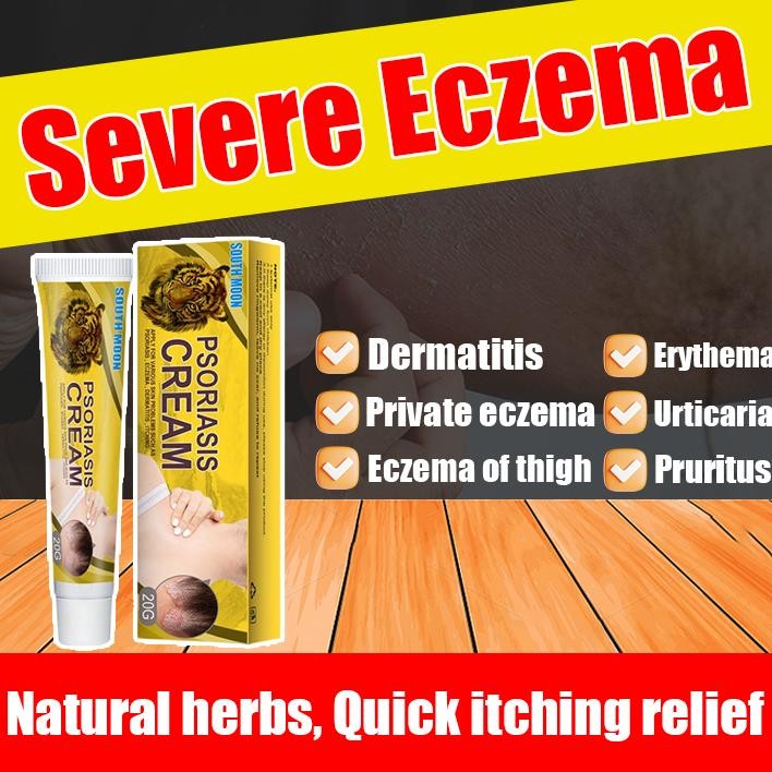 Obat Gatal Selangkangan Salap Gatal Kulit Yang Ampuh Salep Gatal Paling Ampuh 20G Salep Cina Obat Ga