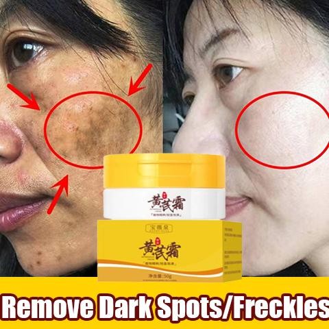 Anti Keriput 50G Anti Penuaan Krim Anti Aging Anti Wrinkle Treatment Anti Aging Penghilang Keriput K
