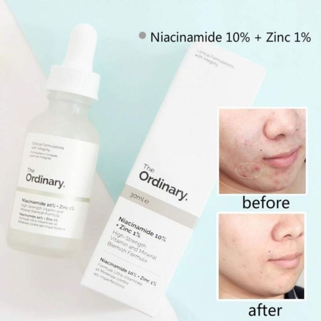 PRELOVED THE ORDINARY