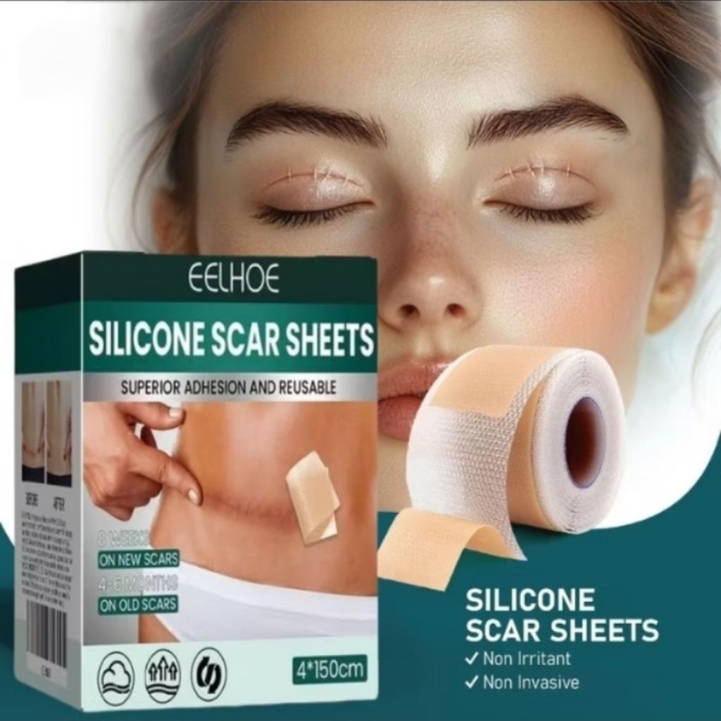 EELHOE Dermaline Silicone Keloid 1Roll Keloplast Silicone Keloid Plester Scar Tape Keloid Bekas