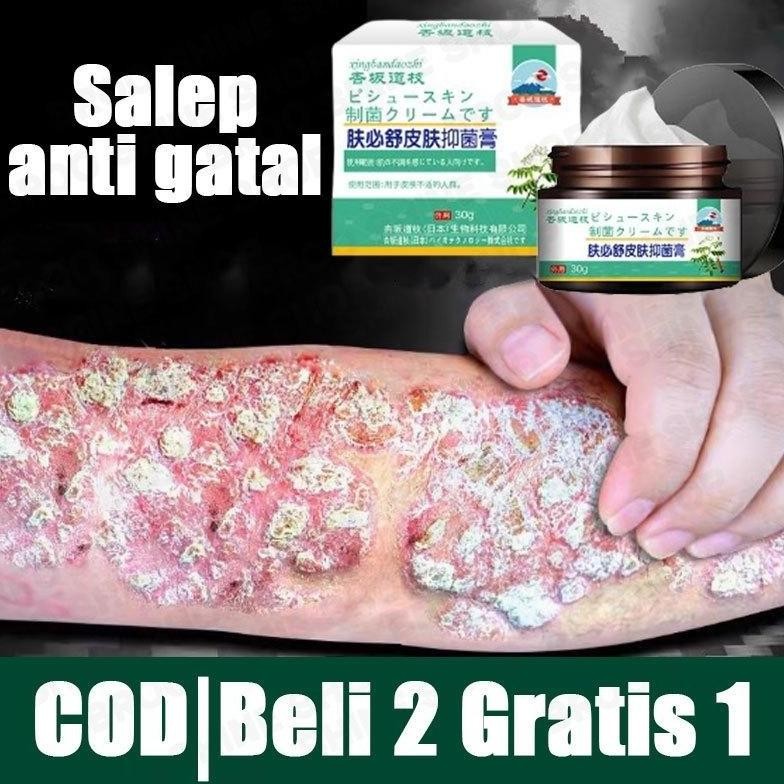 Psoriasis Cream Gatal Seluruh Badan Salep Gatal Kulit Yang Ampuh Salep Gatel Jamur Kulit Obat Gatal 