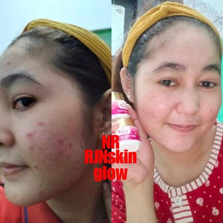 Model baru - CREAM BPOM PEMUTIH WAJAH AMPUH NRGLOW/NR RJNSKINGLOW CREAM GLOWING TERLARIS 