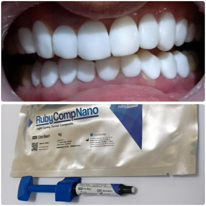 TERBARU Composite Ruby Comp Nano Veneer EW 4gr made in Turkey BISA GOSEND