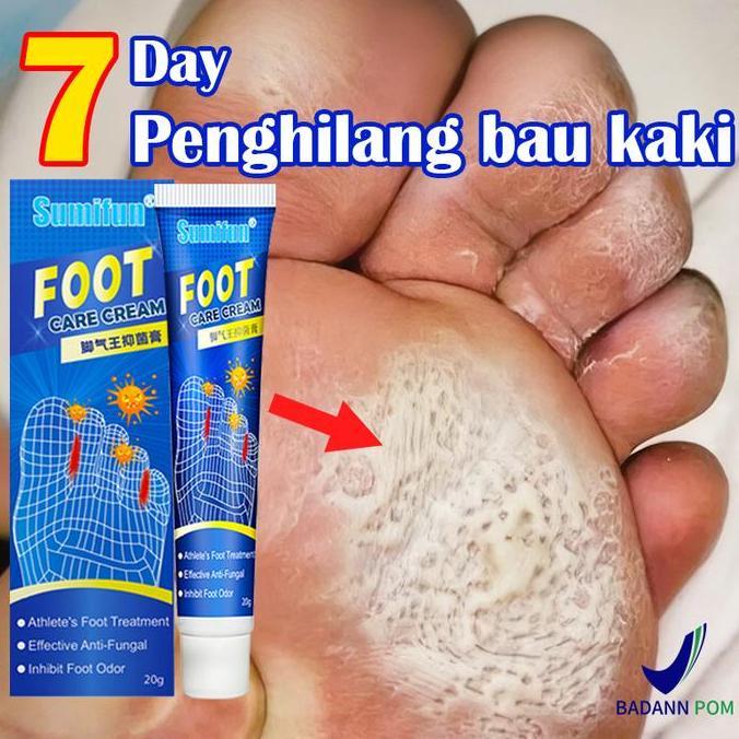 Obat Jamur Kaki Salep penghilang bau kaki Anti Jamur Kaki Gatal&Kurap/obat jamur kaki/Henti gatal ce