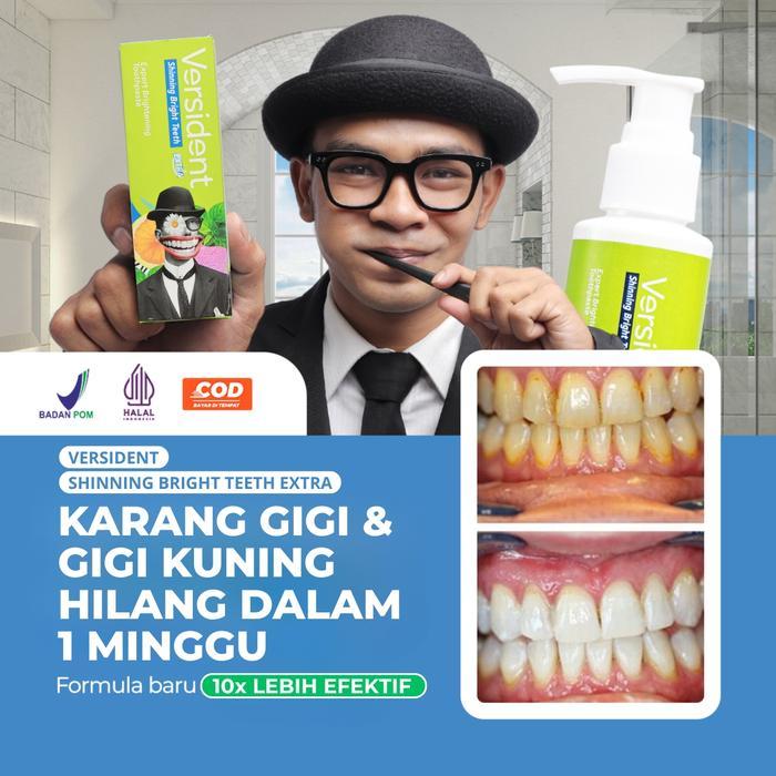 (PROMO LOYAL CUSTOMER) Versident Pasta Pemutih Gigi & Mouth Spray Pengharum Mulut - Pemutih Gigi, Pe