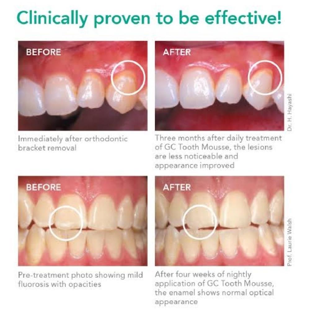 GC Tooth Mousse