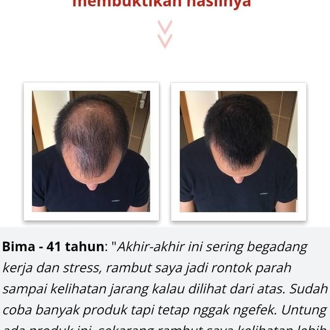 DHT Hair Growth Serum & Shampoo Penumbuh Rambut Original