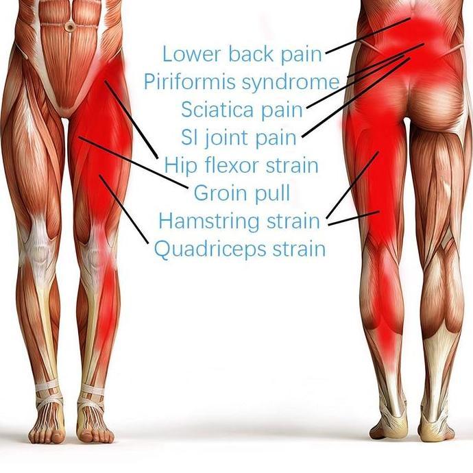 Deker Paha Thigh Brace Penyangga Paha Sciatica Pain Relief Hip Brace