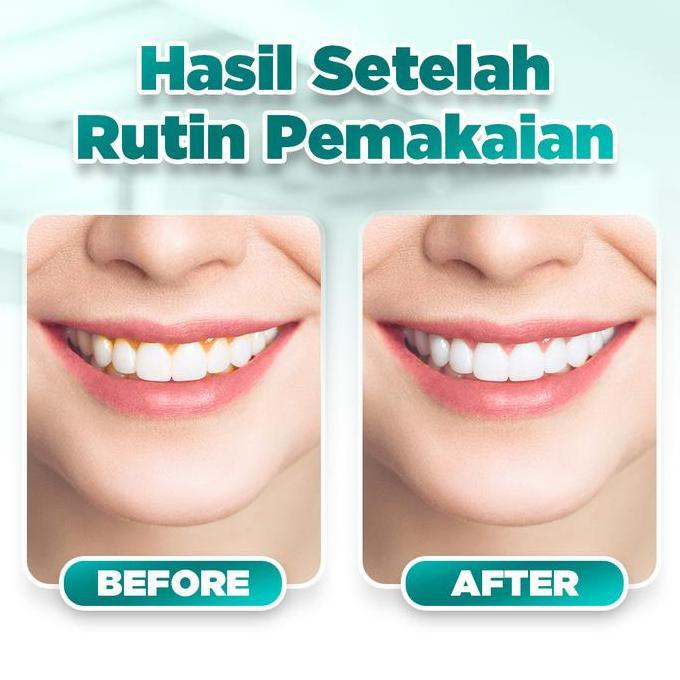 Pieras Propolinse Sikat Gigi Elektrik dan 5 Botol Propolinse LLS