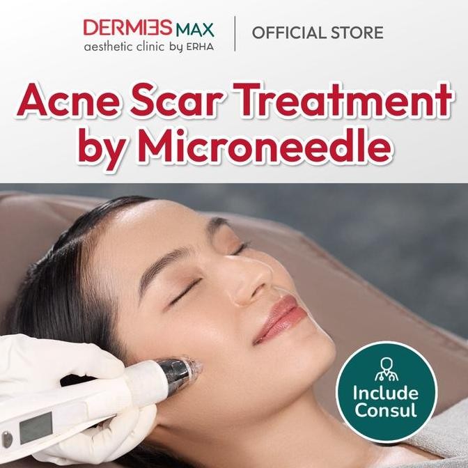 TERBARU - Dermies Max Dermies Acne Scar Treatment by Microneedle
