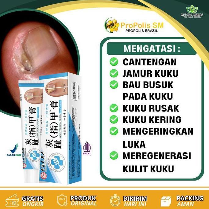 Obat Kuku Obat Jamur Kuku Perawatan Jamur Kuku Rusak Berjamur Nail Care Anti Jamur Perawatan Kuku ob