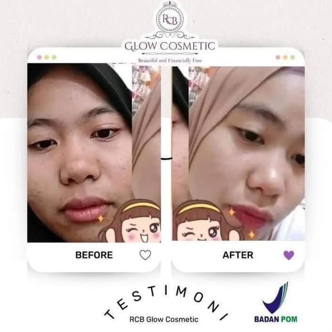 Facene- Rcb Glow Cosmetic Bpom Peratan Jah Skincare Bpom Azz Beaute