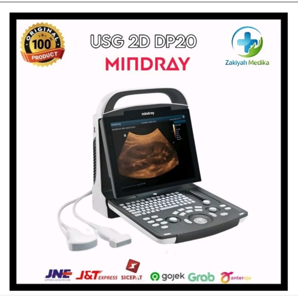 USG MINDRAY - DP20 | usg Mindray DP-20 [ 2D ] Default