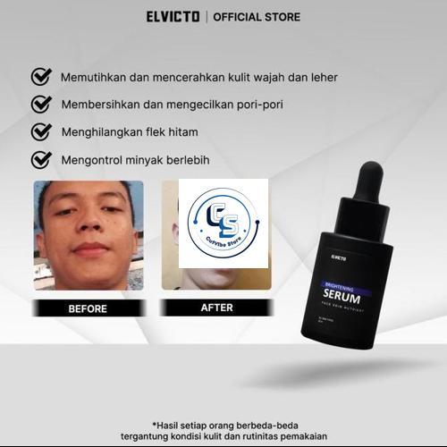 ELVICTO BRIGHTENING SERUM 30 ML PENCERAH WAJAH PRIA SERUM ELVICTO