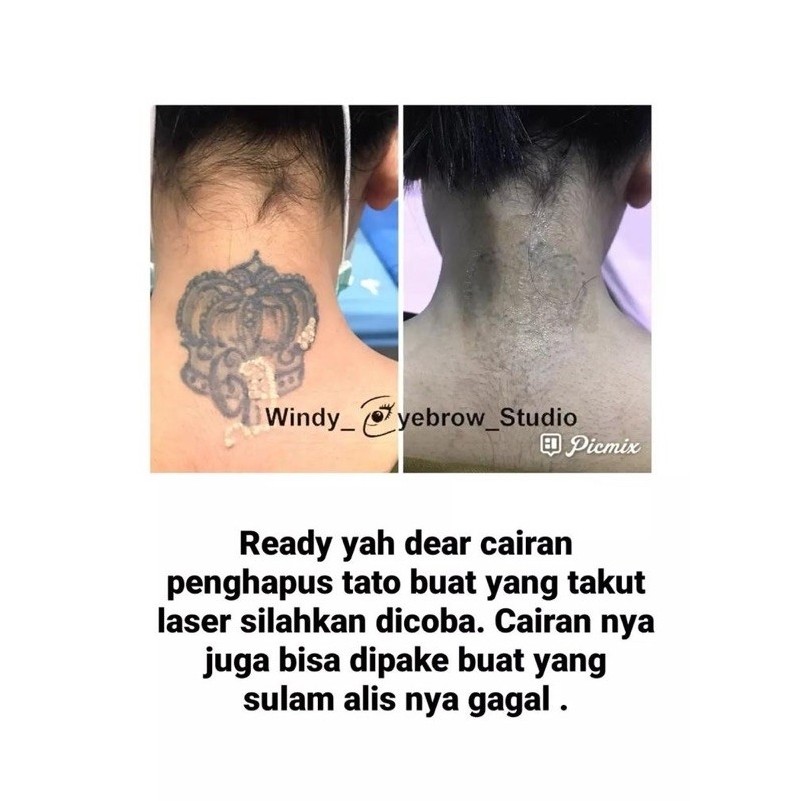 Cairan Penghapus tato untuk menghilangkan tato dan sulam alis