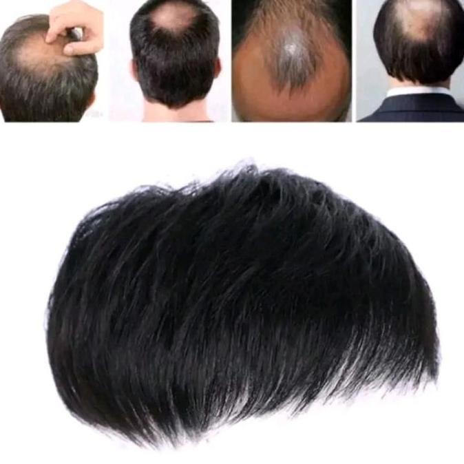 TOUPEE PENUTUP RAMBUT BOTAK PRIA WIG PRIA SEBAGIAN