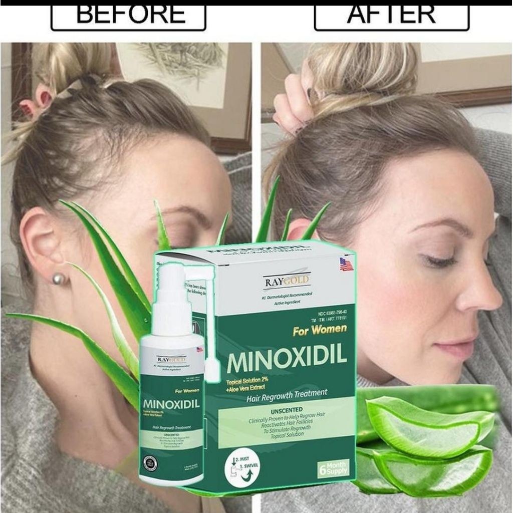 MINOXIDIL 2% penumbuh rambut with Aloe Vera for WOMEN made in USA - RAYGOLD - MINOX MINOKSIDIL anti 