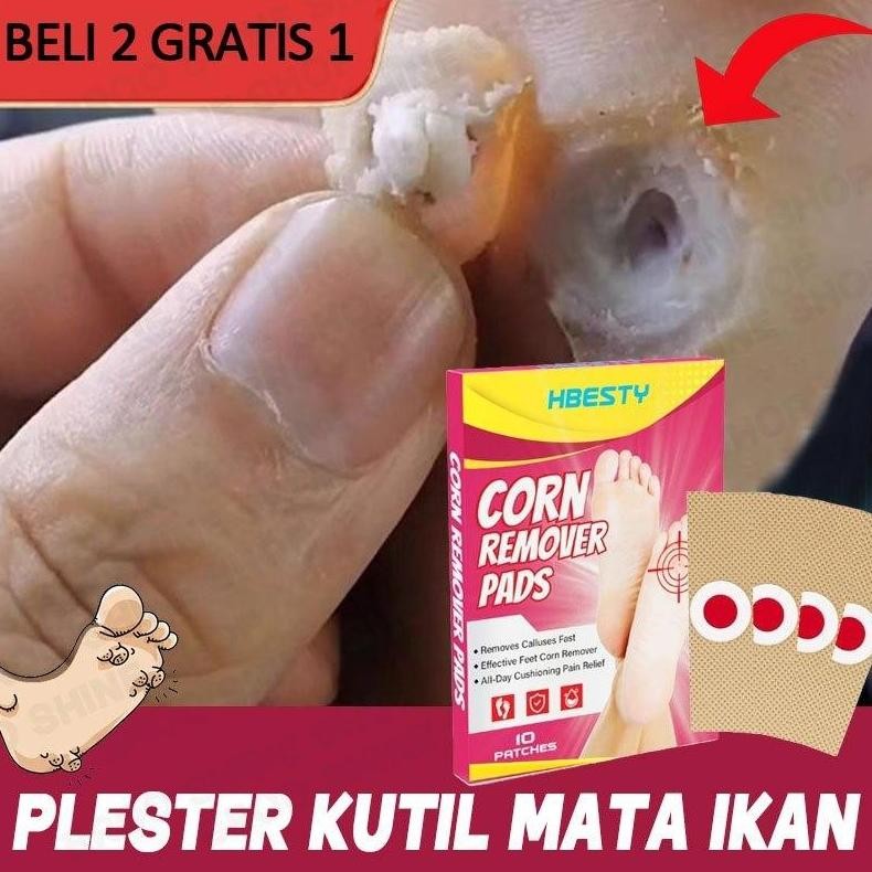 Obat Kutil Plester Mata Ikan Dan Kutil Plester Kutil Penghilang Kutil Kaki 10Pcs Foot Corn Remover S