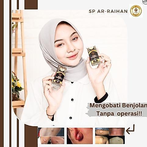 Top Trending / / / / - Baahirah - Benjolan Dileher - Obat Benjolan - Minyak Oles Baahirahori - Tiroi