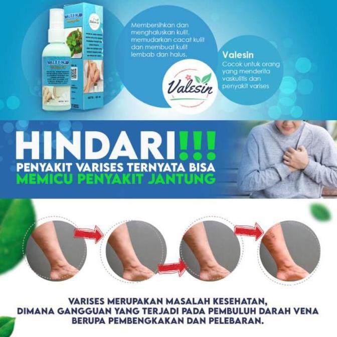 Beautyhealth- Valesin Id P Varises Minyak Kulit