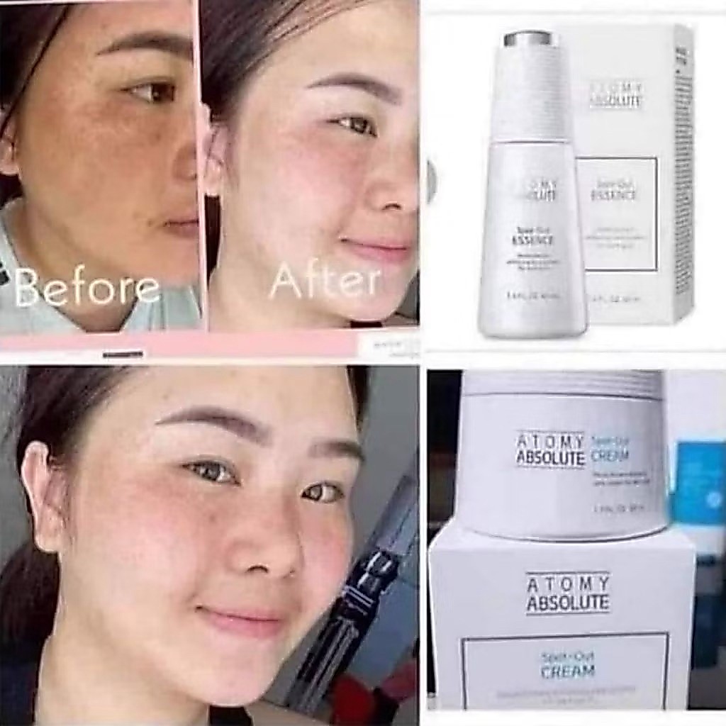 Atomy Absolute 2in1 Spot out cream & spot out essence wajah flex ori ready