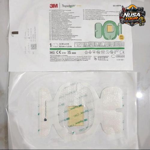 3M Tegaderm 1657R CHG Dressing 3,5 x 4,5 Steril and Bacterial