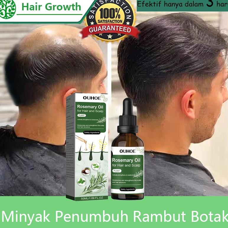 Serum Penumbuh Rambut Botak Rosemary Oil Rambut Obat Penumbuh Rambut Hair Growth Serum Minyak Penumb