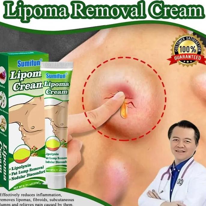 Facene- Lipoma Cream P Benjolan Herbal Ampuh Lipoma Cream P Benjolan 7 Days Lipoma Removal Cream