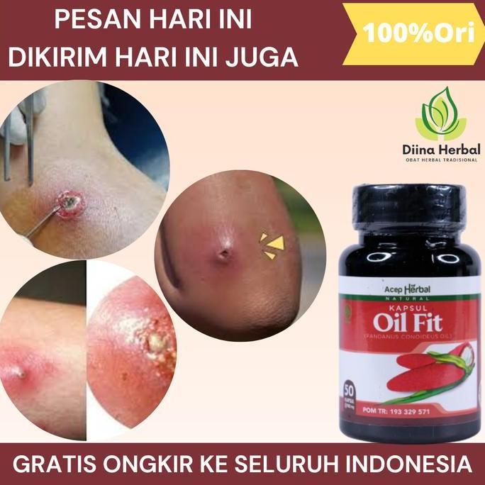 Coolbit- Bisulan Dipantat, Bisul Bernanah, Bisul Gak Tumbuh Lagi, Bisul Di Kemaluan, Penghilang Bisu