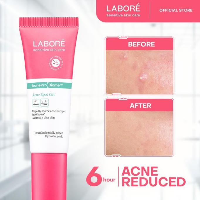 [Gift Not For Sale] LABORE Sensitive Skin Care Acne Spot Gel 15 ml (TERBAIK) (TERBARU) (TERMURAH)