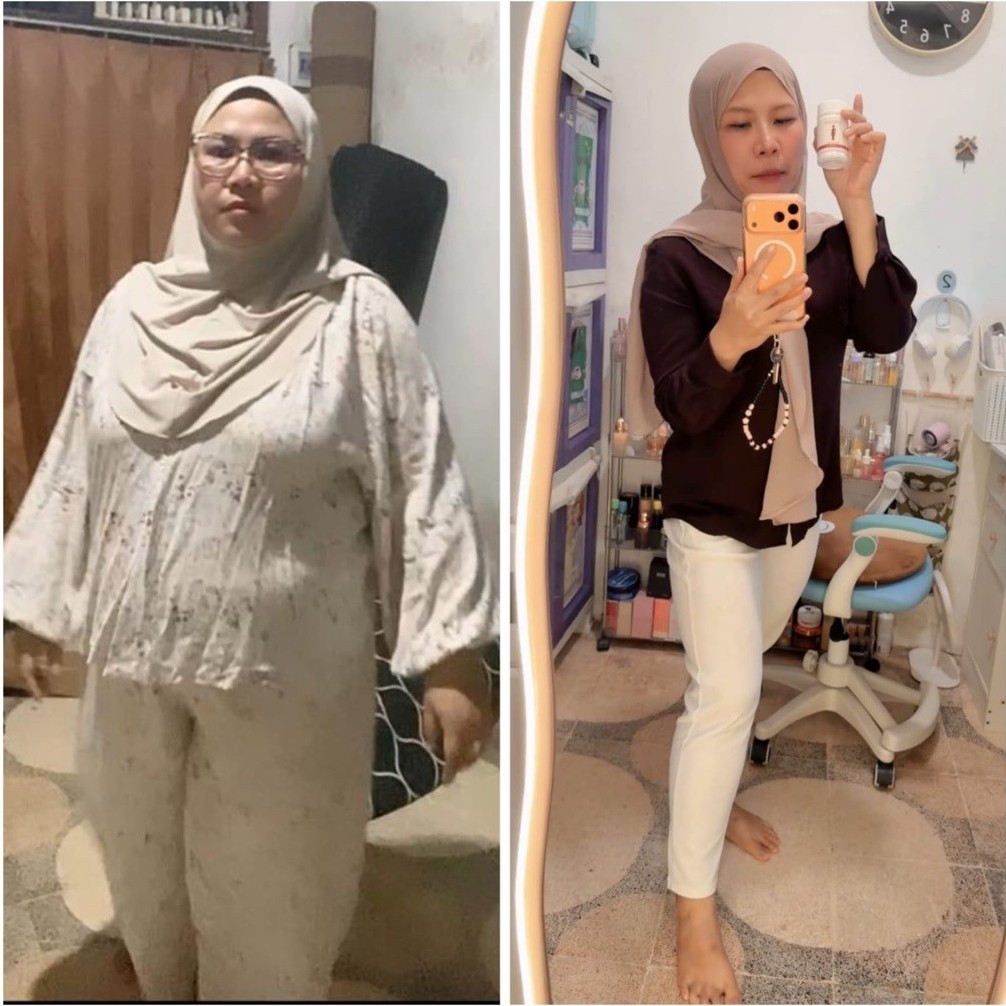 OBAT DIET BPOM | PIL PELANGSING BPOM | PAKET DIET PELANGSING BPOM | PIL DIET STRONG