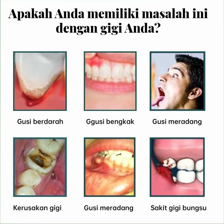 Obat Sakit Gigi Semprot Semprotan Pereda Nyeri Obat Sakit Gigi Berlubang Obat Sakit Gigi Berlubang A