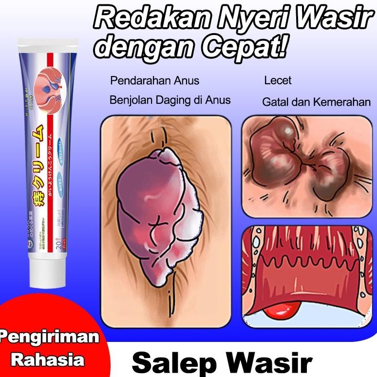 Jepang Obat Wasir Salep Wasir Salep Ambeien Paling Ampuh 20G Meredakan Ketidaknyamanan Wasir Formula
