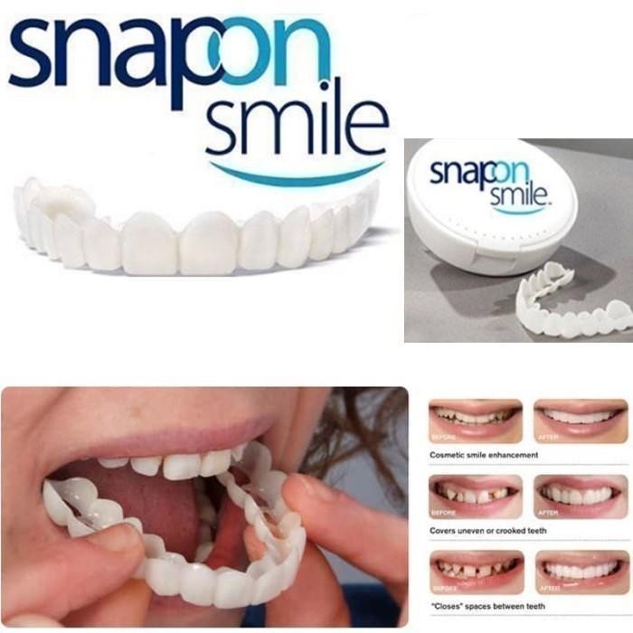 Snap On Smile Paket Karet Gigi Palsu 1 Set Atas Bawah Original