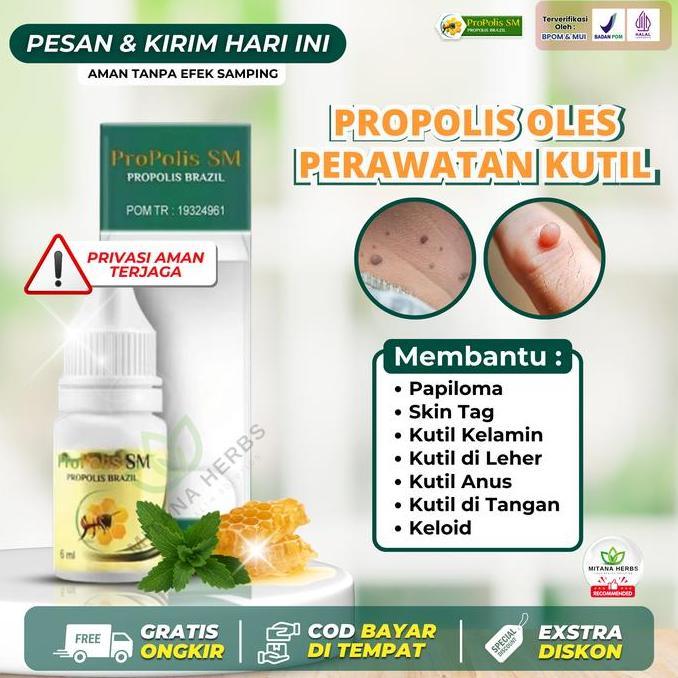 Pele - Propolis Sm Penghilang Kutil, Menghilangkan Kutil Kelamin, Kutil Di Leher, Kutil Anus, Skin T