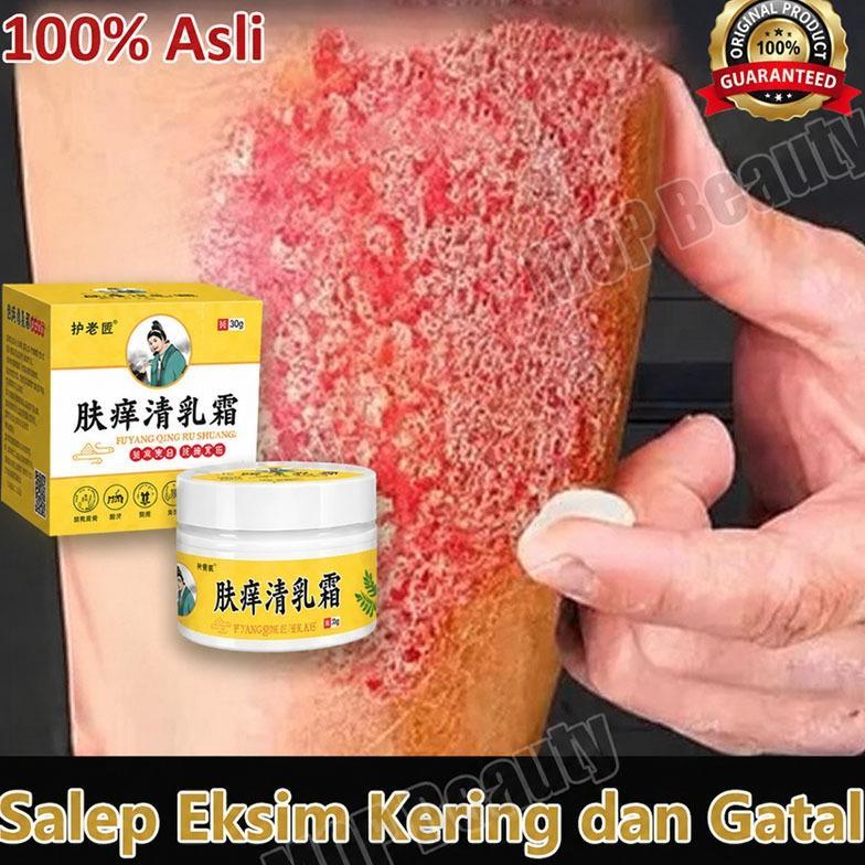 Salap gatal china obat gatal selangkangan salep eksim kering dan gatal obat eksim psoriasis cream Me