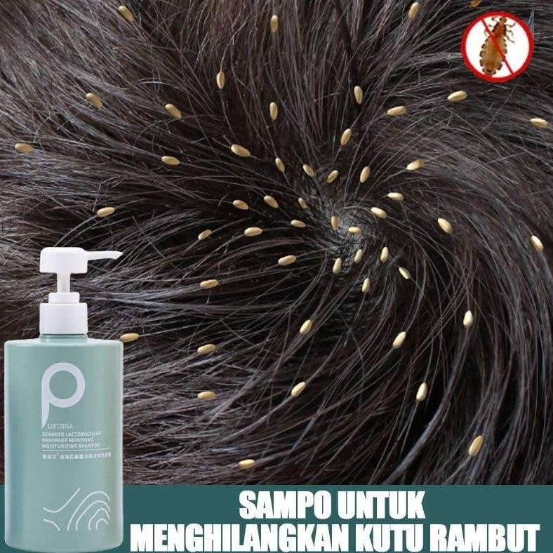 Shampoo Kutu Rambut Shampoo Anti Ketombe Sampo Kutu Sampo Ketombe Shampoo Anti Kutu Shampoo Kutu Ram