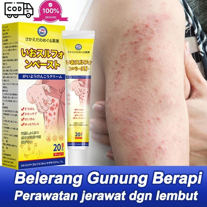 Salep Eksim Salep Belerang Cream Anti Gatal 20G Untuk Dermatitis Kulit, Eksim Kulit, Gigitan Serangg
