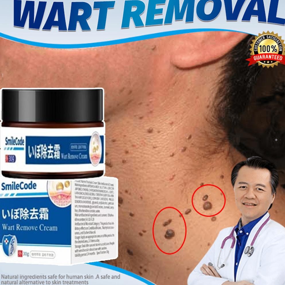 Cream Penghilang Kutil 30G Obat Kutil Salep Kutil Paling Ampuh Penghilang Kutil Dan Tahi Lalat Pengh