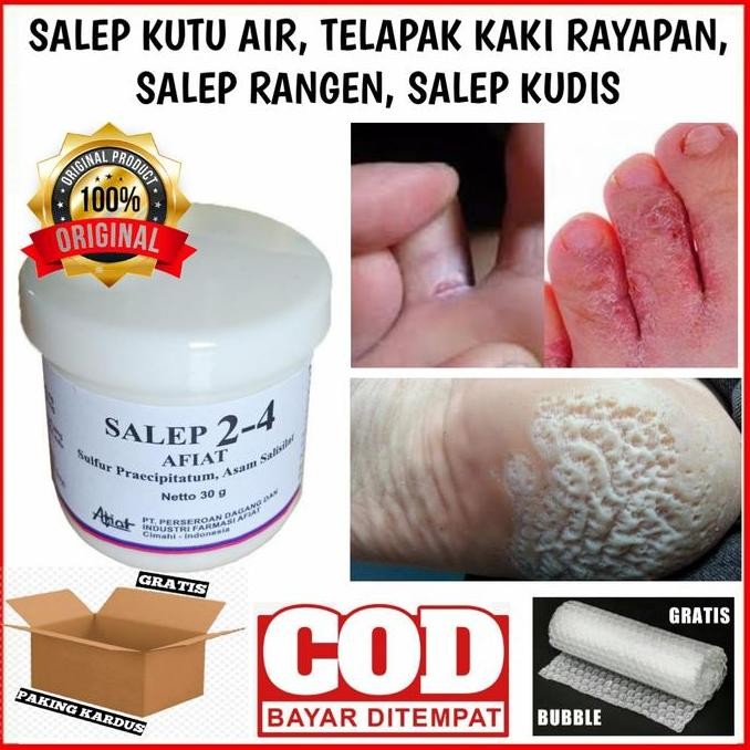 SALEP KUTU AIR TELAPAK KAKI RAYAPAN TELAPAK KAKI RANGEN OBAT KUTU AIR