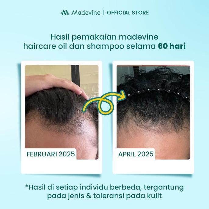 Hairplus- Madevine Hair Oil + Madevine Shampoo - Serum Dan Shampoo Bantu Atasi Penumbuh Rambut, Ramb
