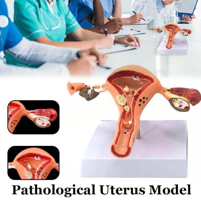 FARMUKE Model Anatomical Uterus Ovary Wanita / Peraga Anatomi Model Patologis Uterus Ovarium