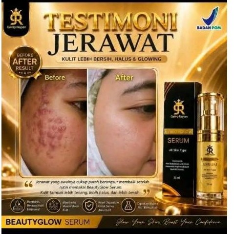 serum 9R galery Rayyan paket seller 3 pcs