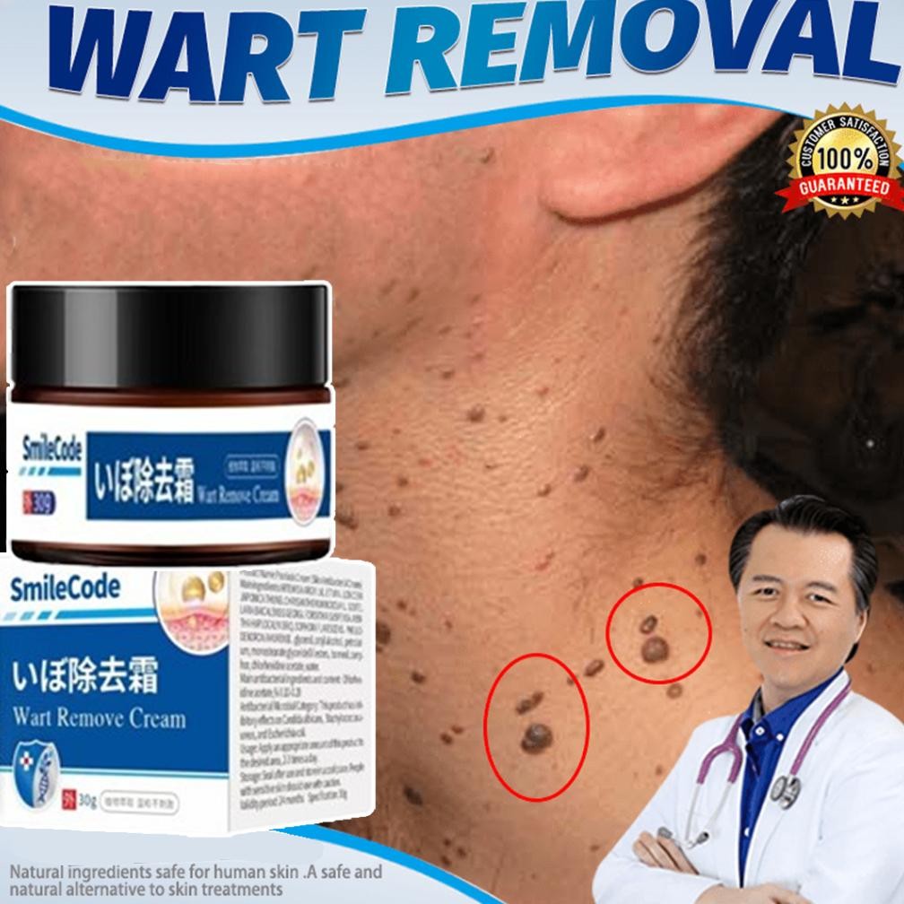 Cream Penghilang Kutil 30G Obat Kutil Salep Kutil Paling Ampuh Penghilang Kutil Dan Tahi Lalat Pengh