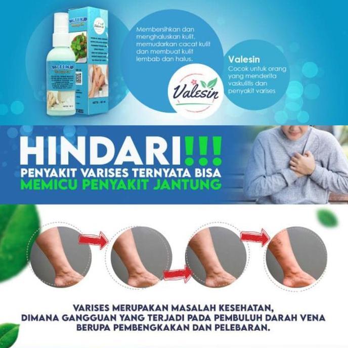 Beautyhealth- Valesin Id P Varises Minyak Kulit