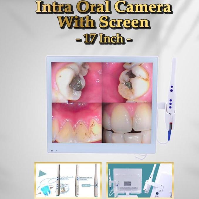 Intra Oral Camera With Screen  17 inch- Dental Intra Oral
