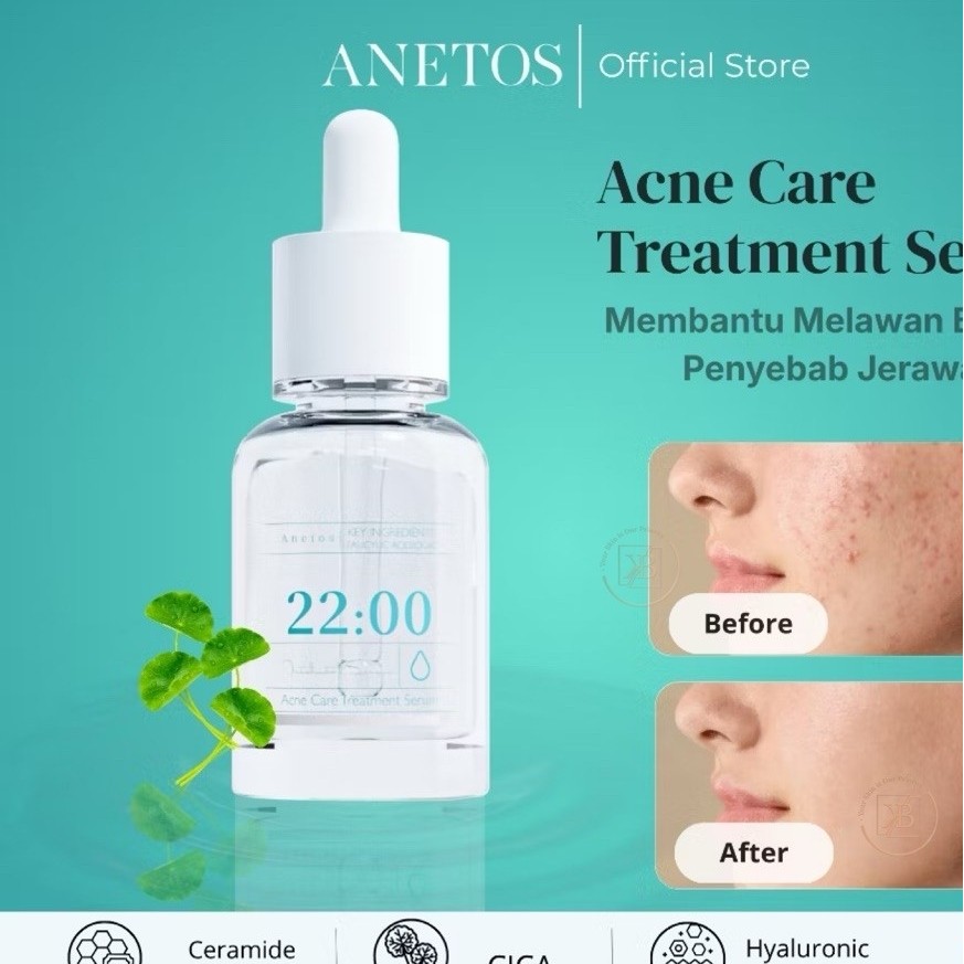 Anetos Acne Care Treatment Serum – 15ml (Serum Wajah, Essence, Membantu Mengatasi Kulit Berjerawat)