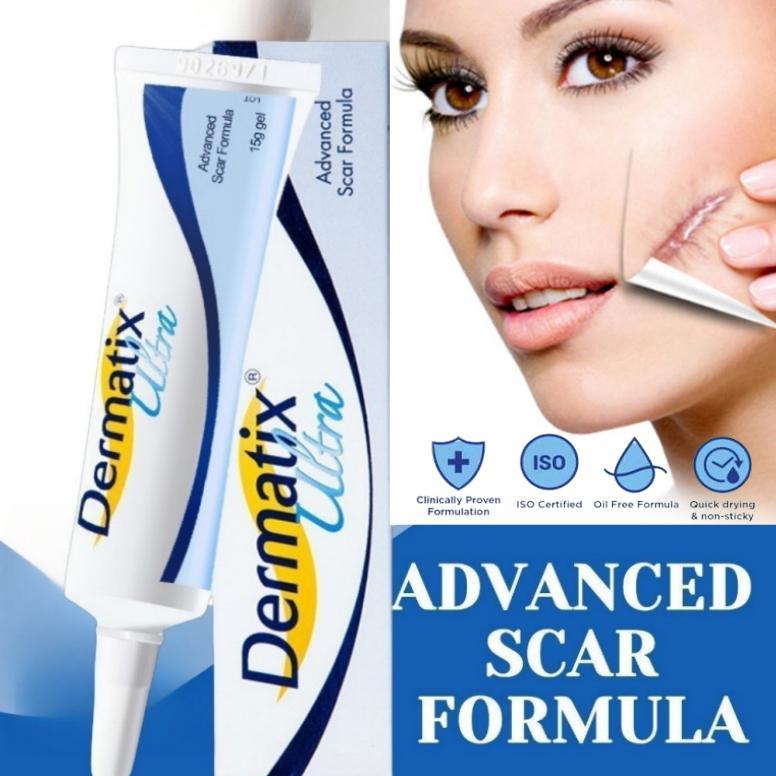 *Beli 3 Gratis 2*Dermatix Penghilang Bekas Luka 15gr / Dermatik Penghilang Bekas Luka ori / Penghila