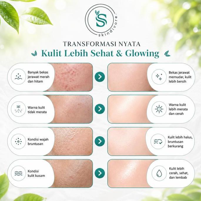 Bellis- [Khusus ] Masker Organik Skindivore Fullsize 60Gr | Bpom