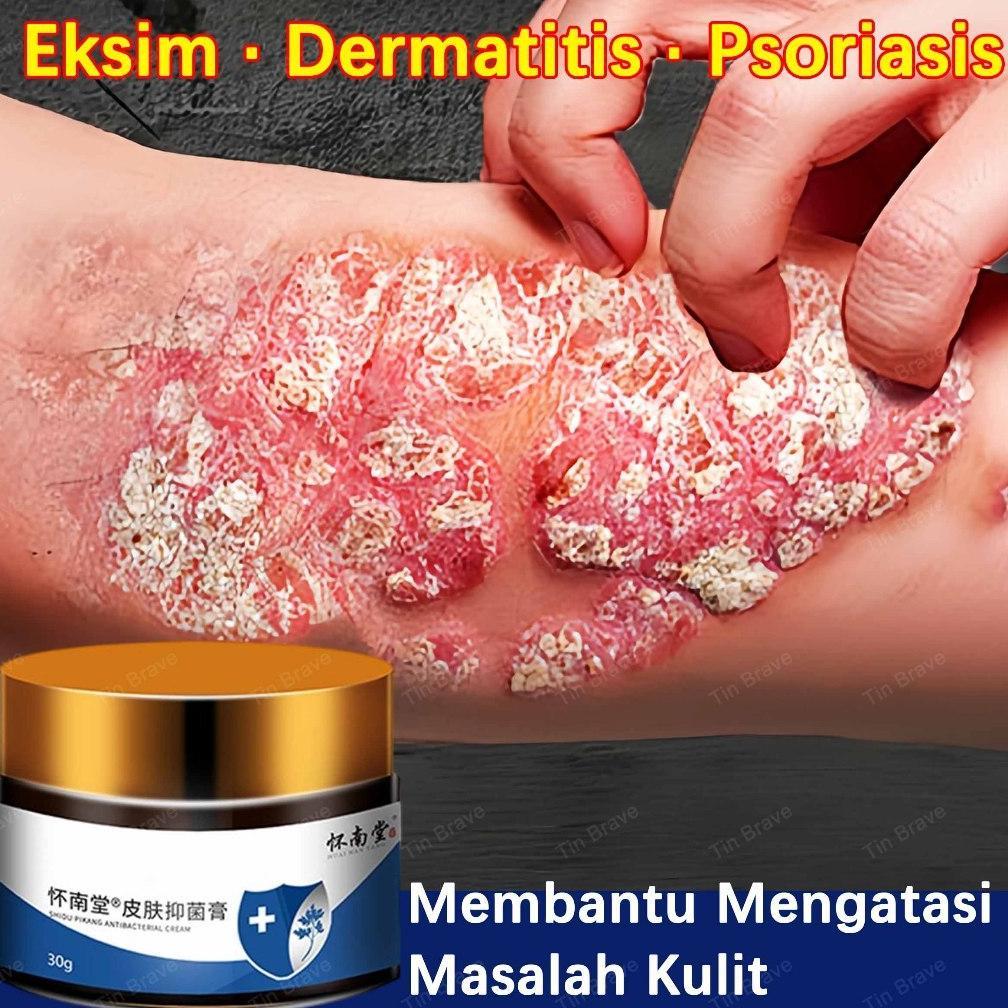salep gatal china salep eksim kering dan gatal paling ampuh obat salep gatal selangkangan salep psor